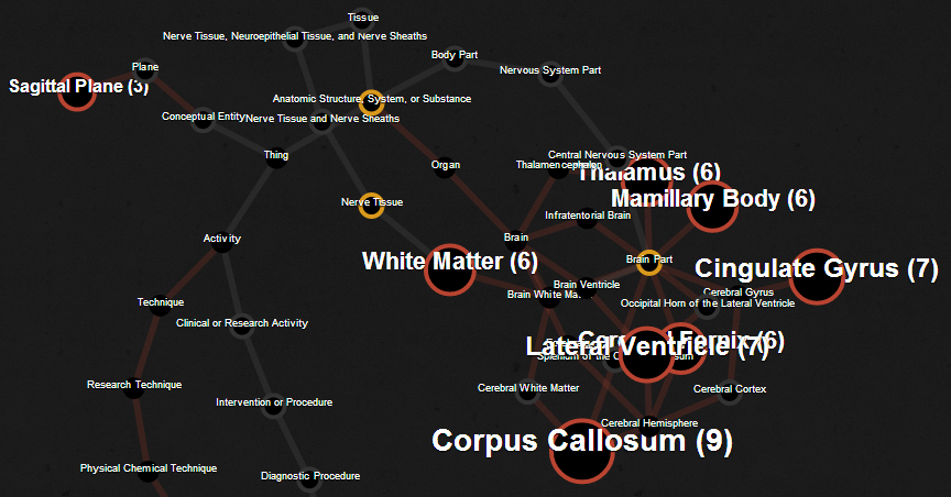 Force Directed Graph with Pan / Zoom